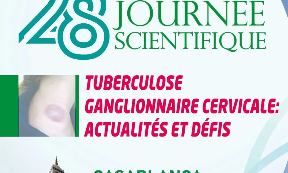 Affiche de la 28ᵉ Journée Scientifique de l'Amicale des ORL de Casablanca, dédiée aux actualités et défis de la tuberculose ganglionnaire cervicale, avec une photo de la mosquée Hassan II et les détails de l'événement le 23 octobre 2024.